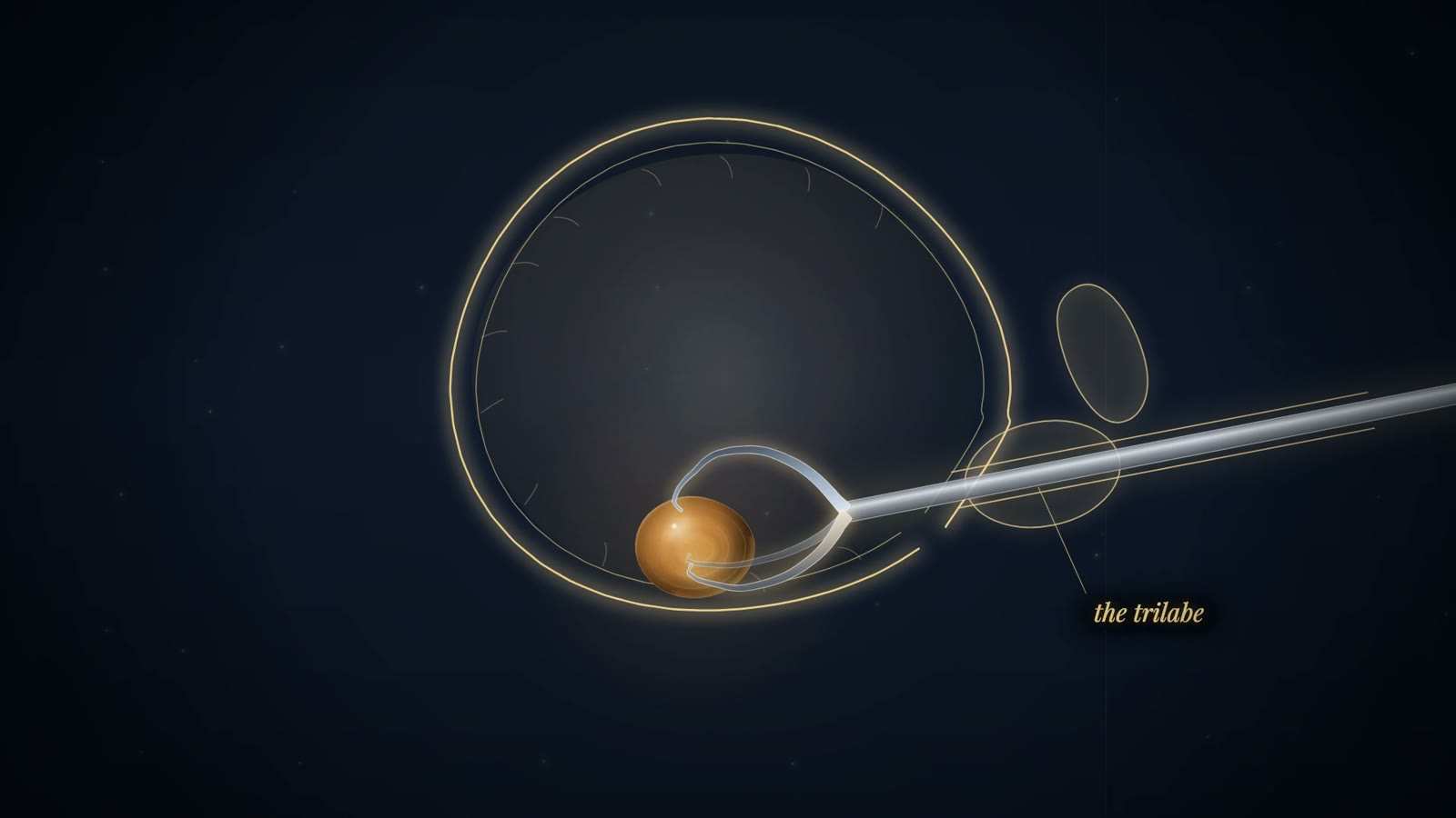 Gold-line bladder with an amber stone held by three curved claws on a straight steel tube entering from the right, labelled the trilabe.