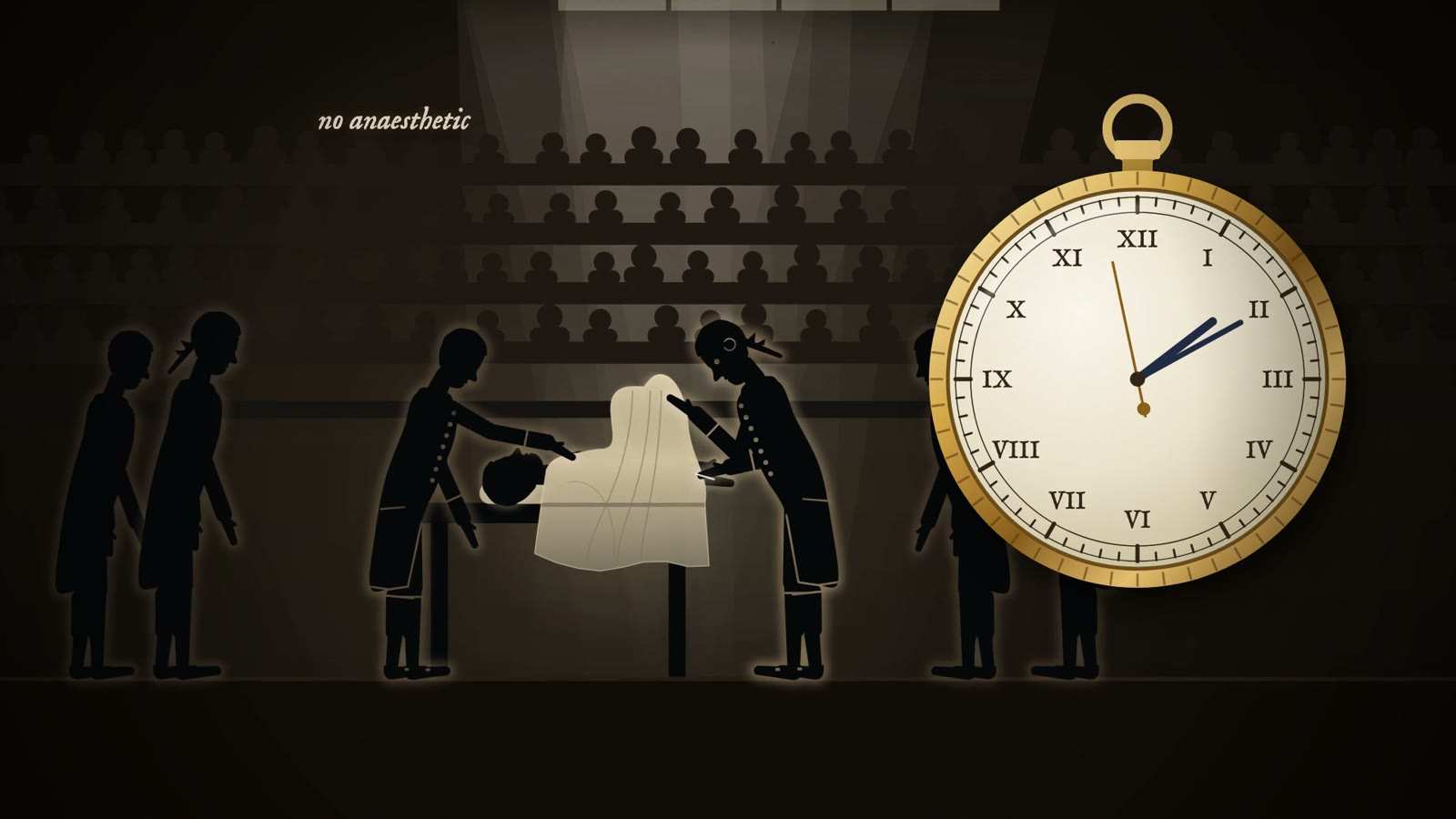 Two surgeons in period dress operate on a covered patient before tiered spectators, beside a large pocket watch, captioned no anaesthetic.