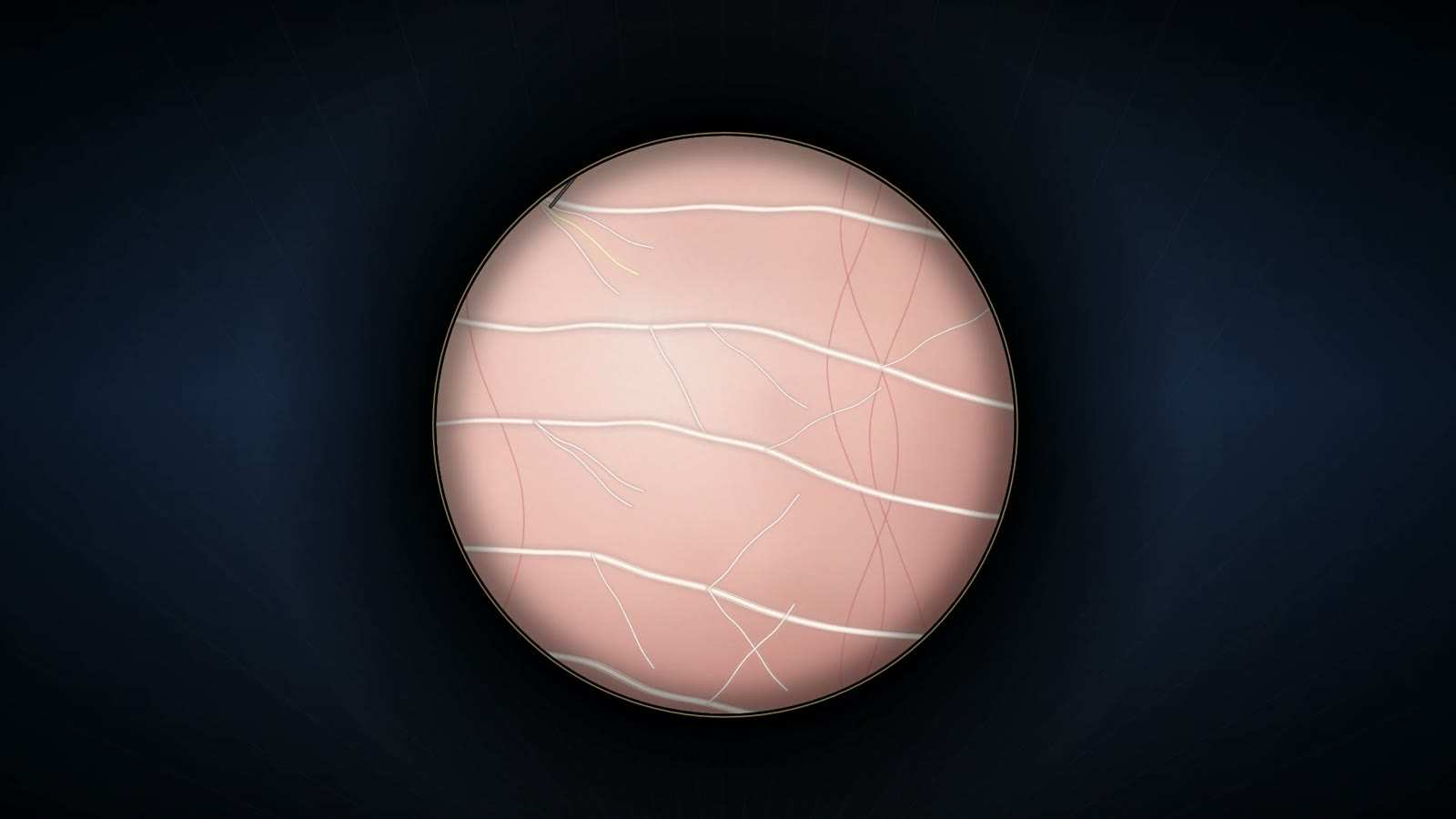 Round microscope field showing fine white nerve threads branching across a pale pink ground, with thin red vessels crossing on the right.